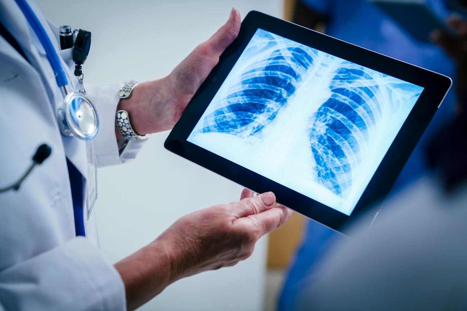 La cage thoracique : le bouclier méconnu qui protège nos organes vitaux