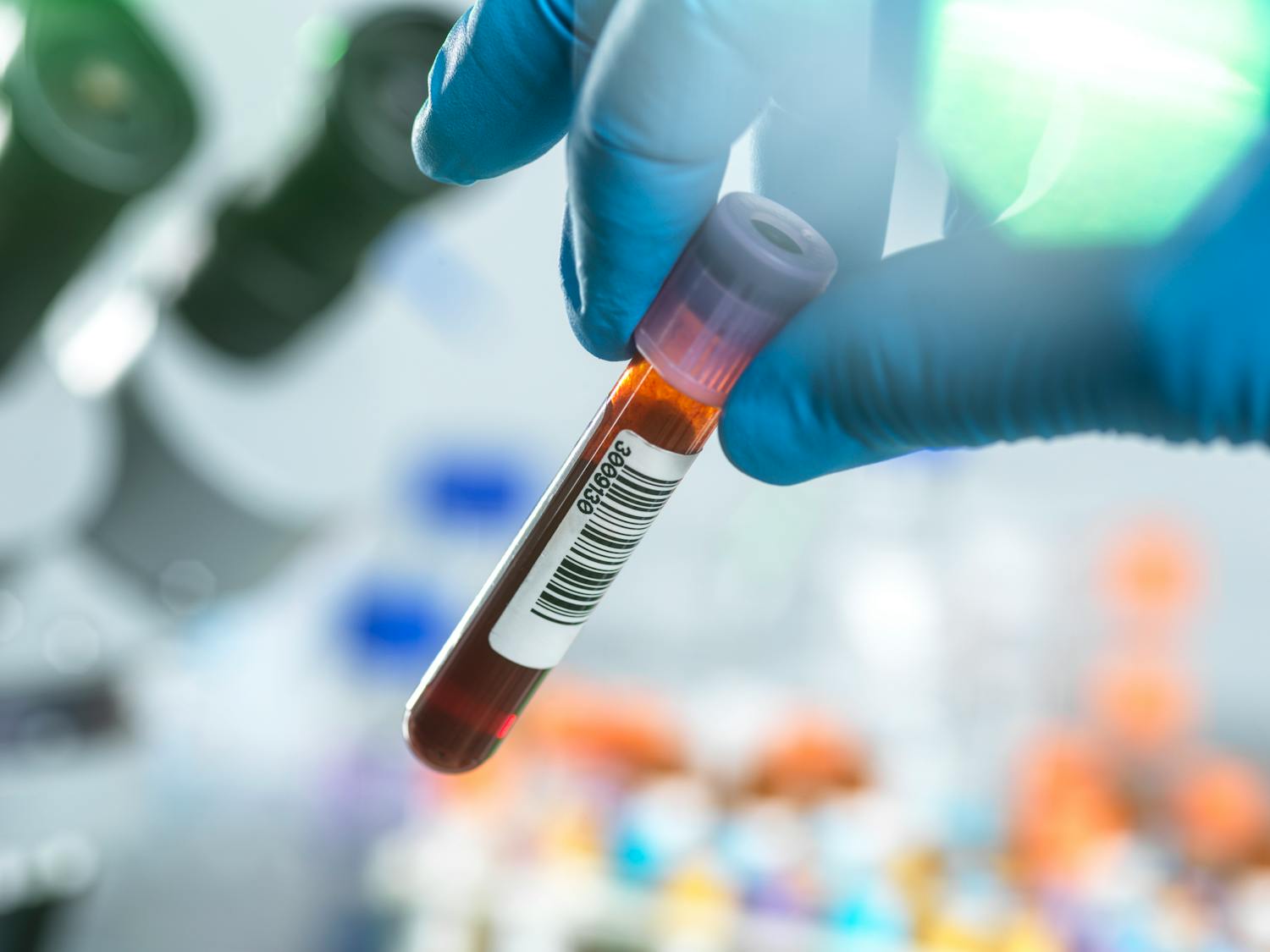 Pourquoi votre médecin prescrit une analyse des plaquettes ?