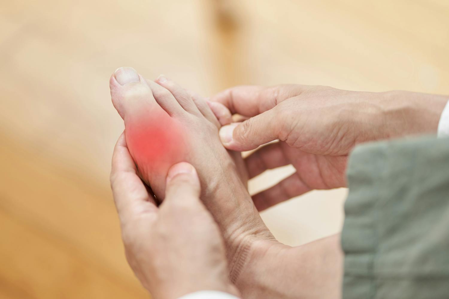 Comment soulager une crise de goutte naturellement ?