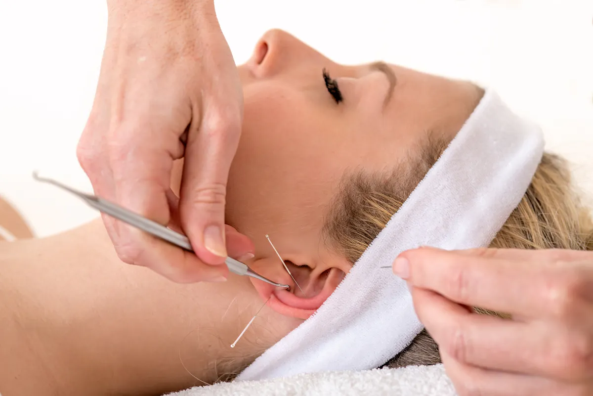 acupuncteur cigarette Acupuncture to Quit Smoking in Brooklyn, NY Pulse Acupuncture Quitting Smoking and Acupuncture -
