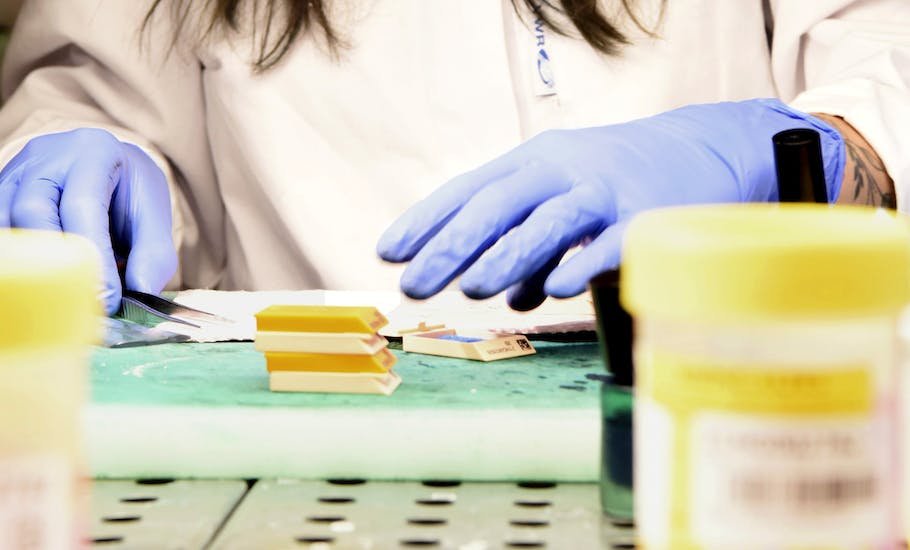 Qu'est-ce qu'un examen histologique exactement ?