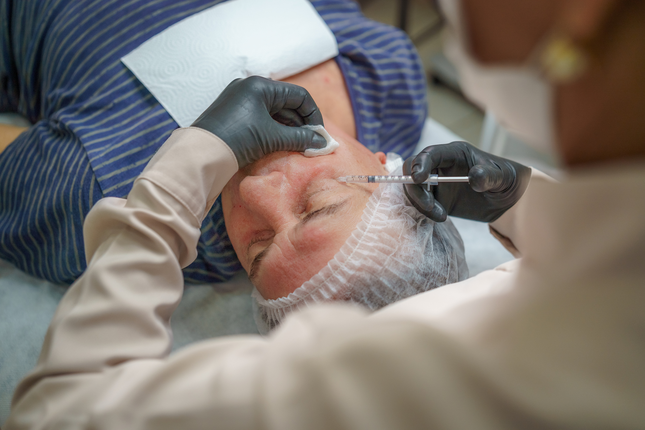 Injections de botox : ces malades chroniques qui feraient mieux de ne pas y recourir selon une étude