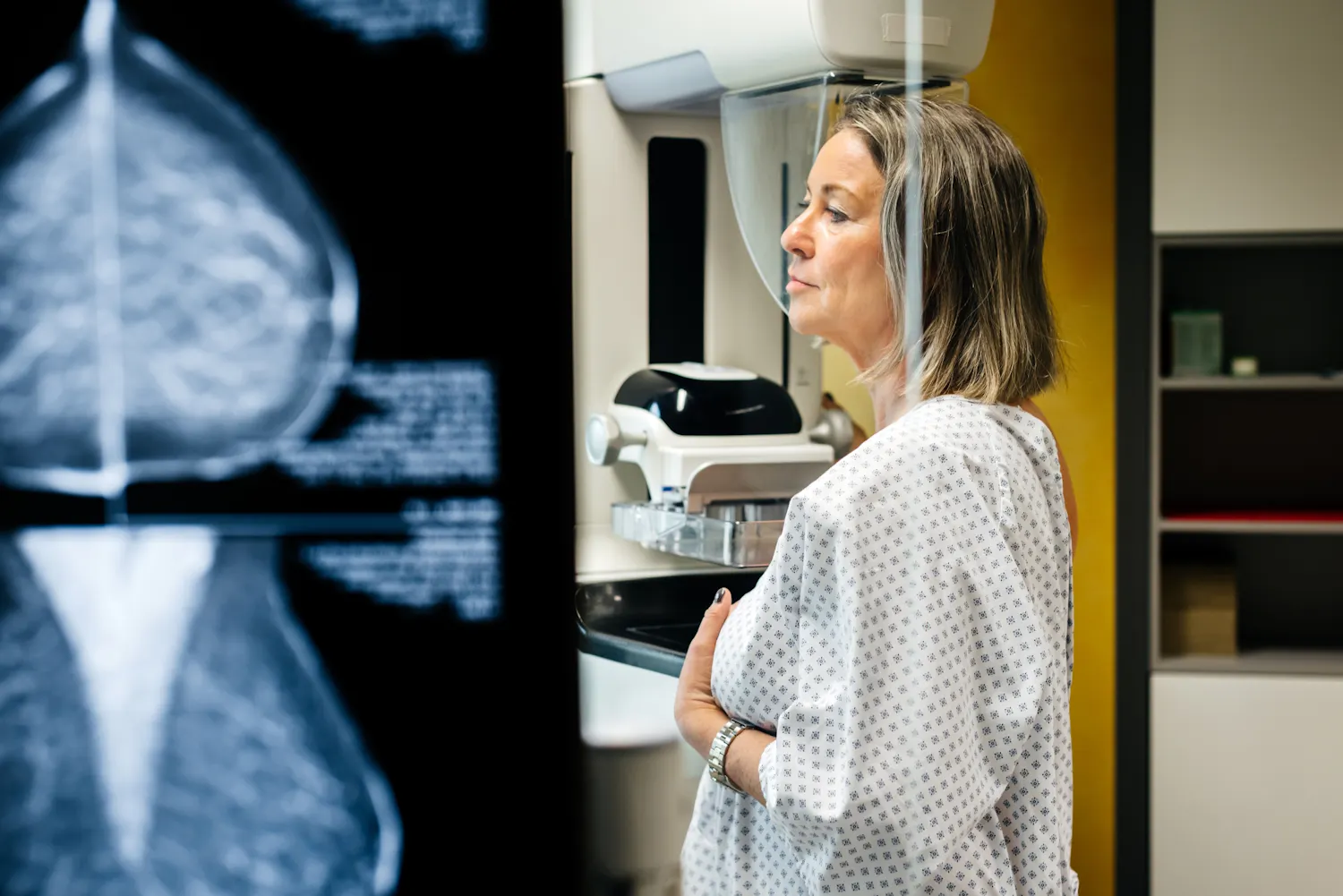 Et si les mammographies permettaient de diagnostiquer une autre maladie ?