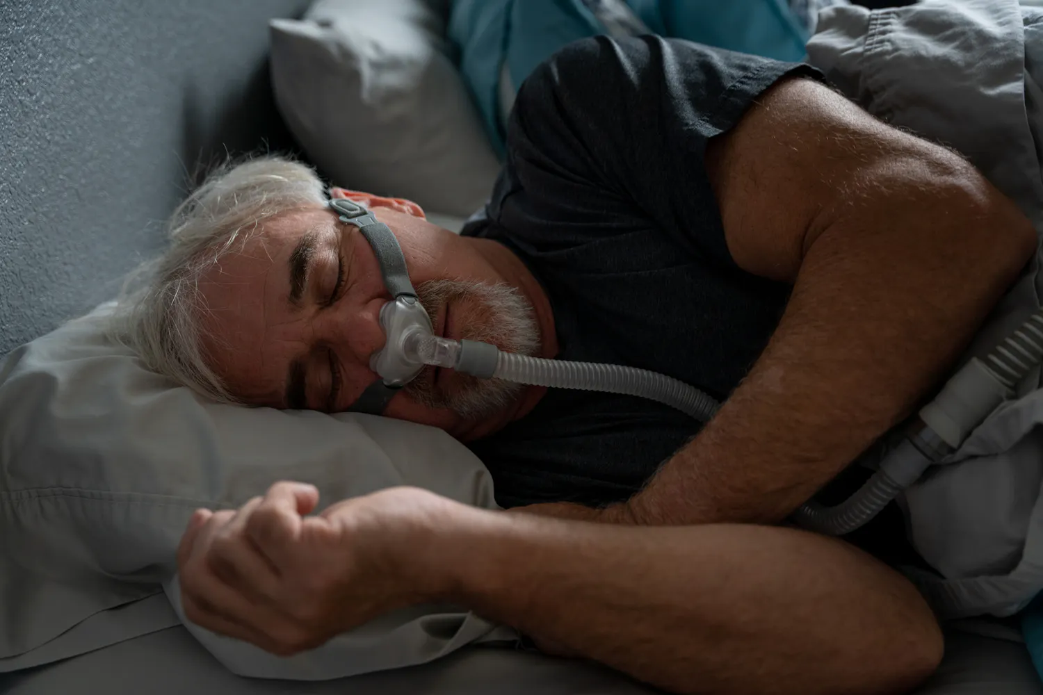 Apnées du sommeil : la HAS précise les conditions de remboursement des dispositifs médicaux
