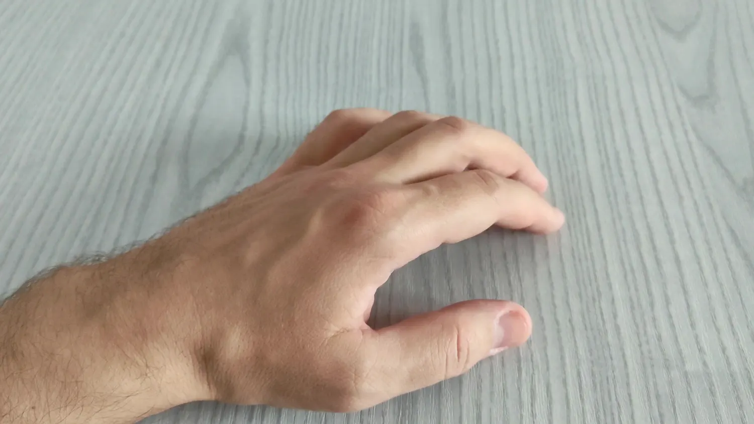 Comment l'IA peut détecter une maladie grave avec une photo de notre main