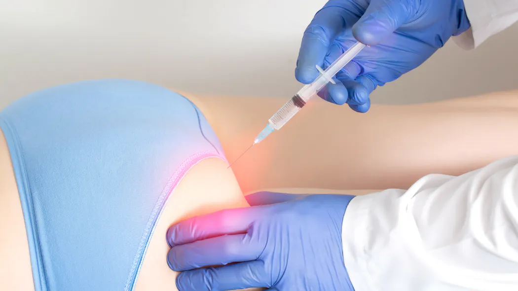 Bbl Injection Brazilian Butt Lift (BBL) : résultats, risques, prix | Santé Magazine