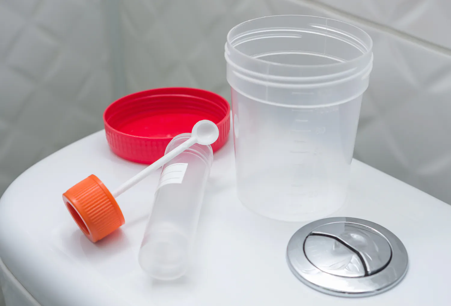 Tout savoir sur l'analyse du microbiote intestinal