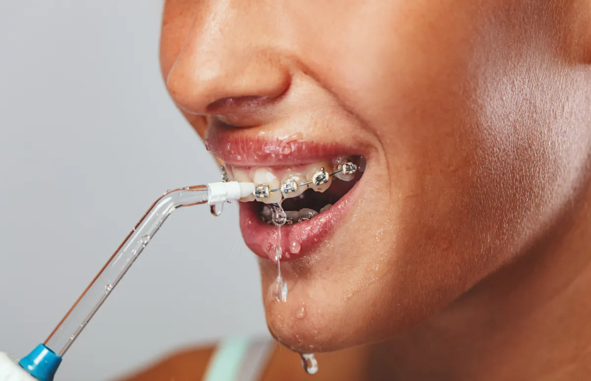Hygiène des dents : un hydropulseur est-il vraiment utile ?