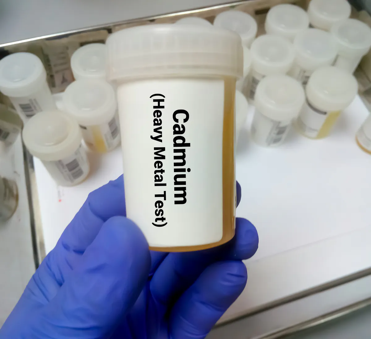 Le dépistage du cadmium bientôt remboursé pour certains : des critères trop restrictifs pour les médecins et associations