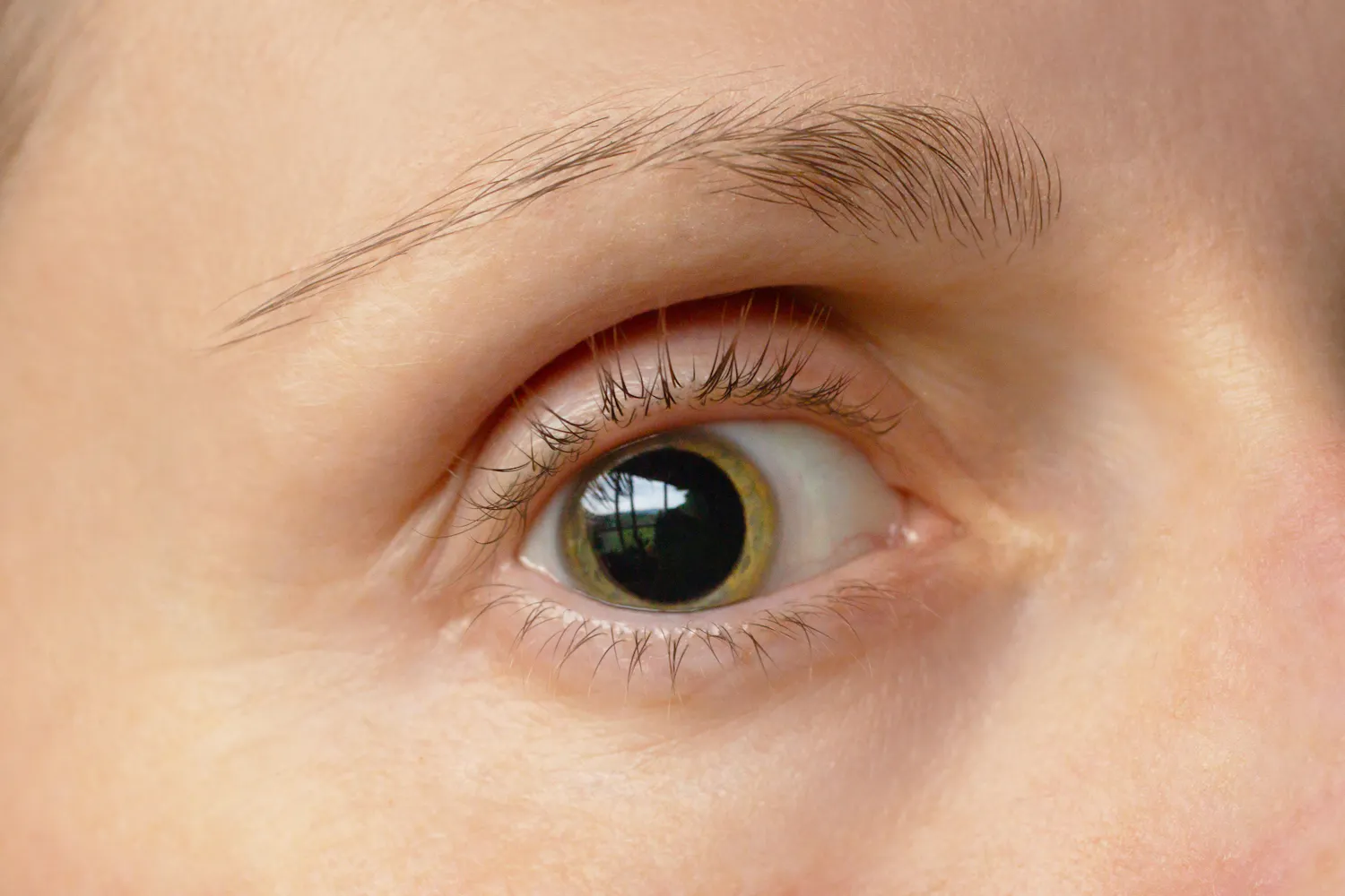 Pupille dilatée : quelles causes ? Quand s'inquiéter ?