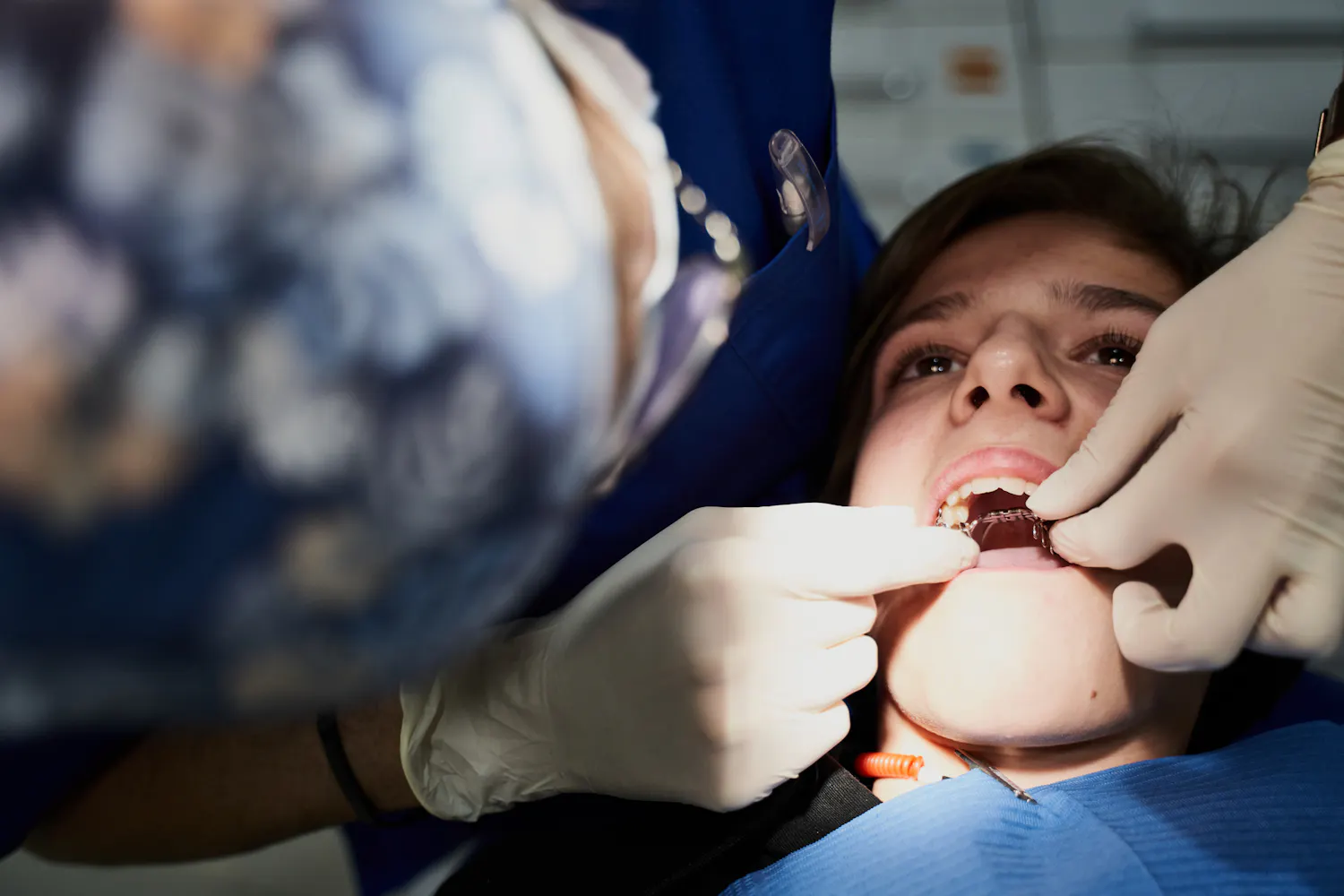 Bagues, gouttières, chirurgie… Comment aligner ses dents ?
