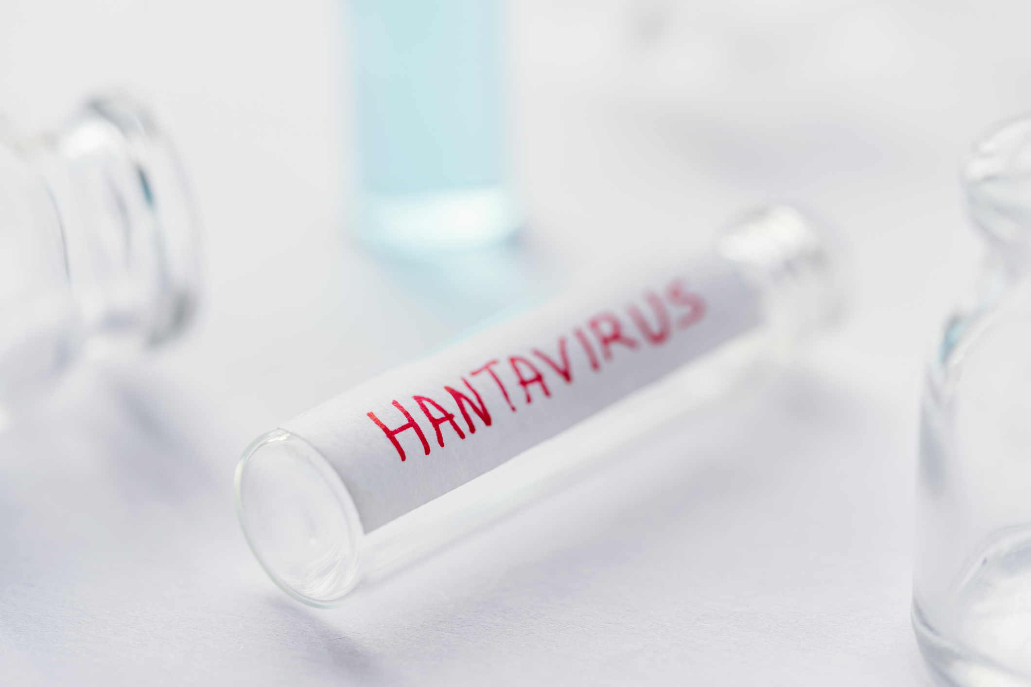 Pourquoi n’existe-t-il pas de vaccin contre l’hantavirus ?