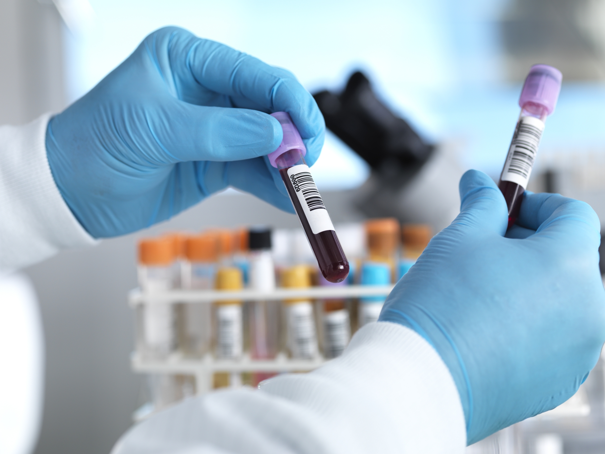 Cancer colorectal : la mise en lumière de mécanismes biologiques inattendus