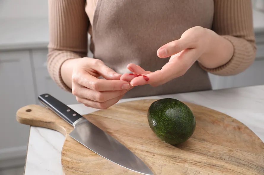 Personne soignant une coupure au doigt près d'un avocat et d'un couteau sur une planche.