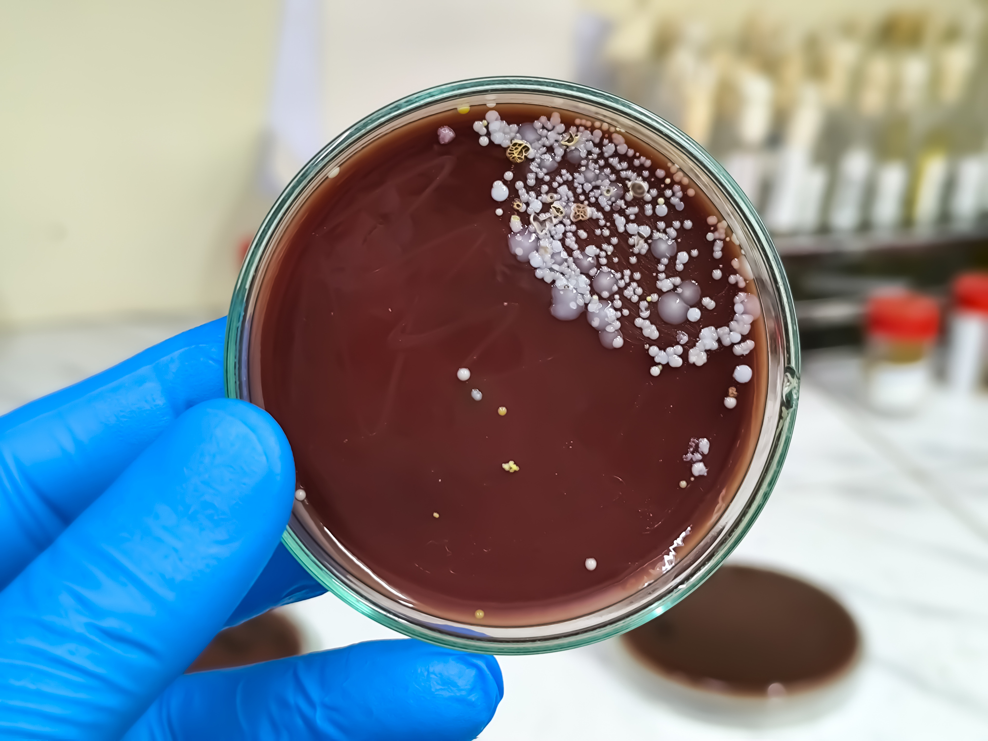 Candida auris : ce champignon pathogène envahit les maisons de retraite
