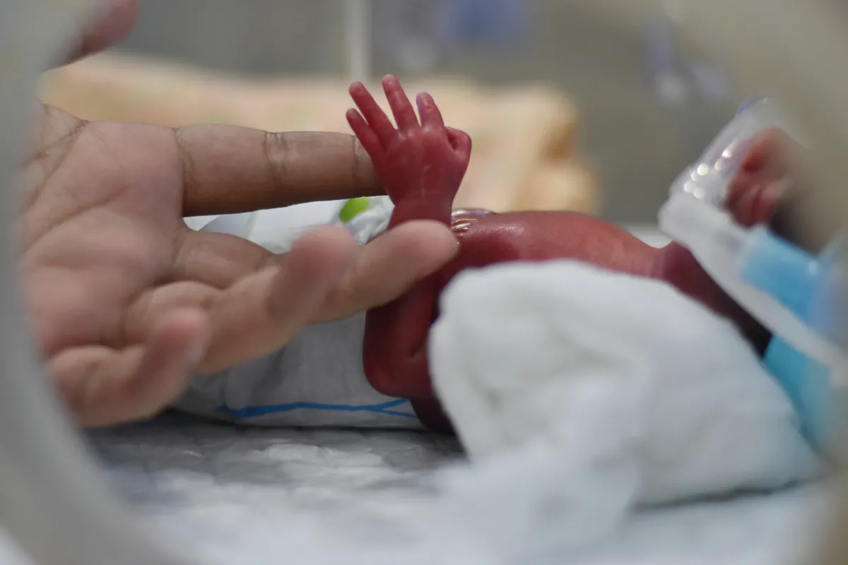 351 grammes et seulement 21 semaines de grossesse : en Australie, un bébé né prématuré survit, à la surprise des médecins