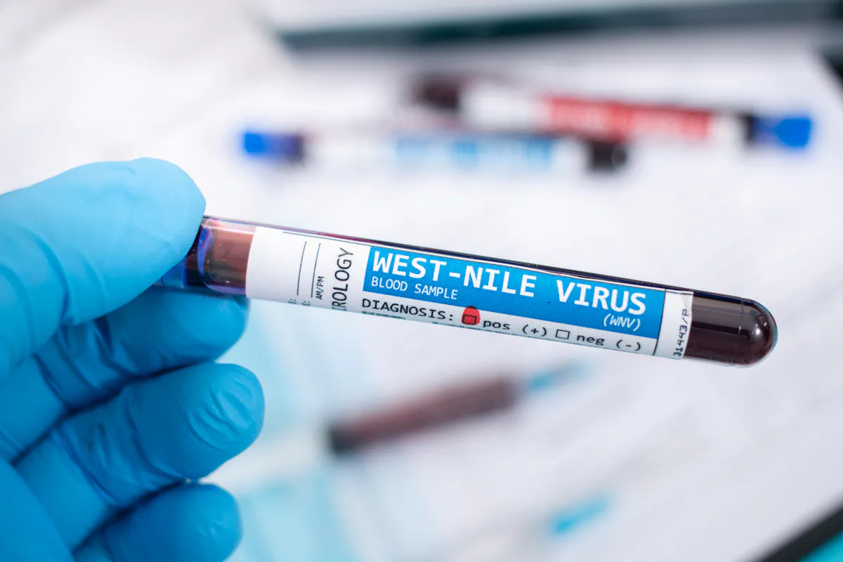 Des cas d’encéphalite due au virus du Nil occidental dans les Pays de la Loire : l’ARS annonce davantage de surveillance