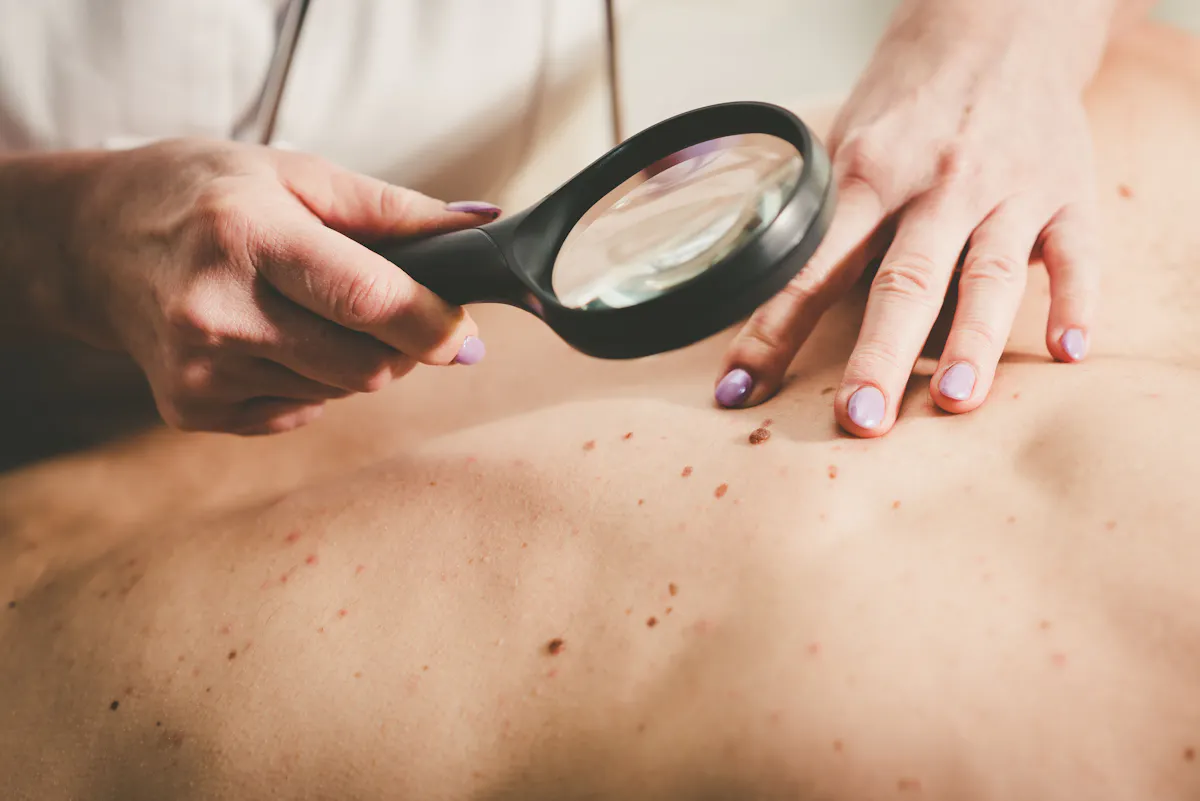 Une cartographie mondiale révèle de profondes inégalités d’accès aux dermatologues