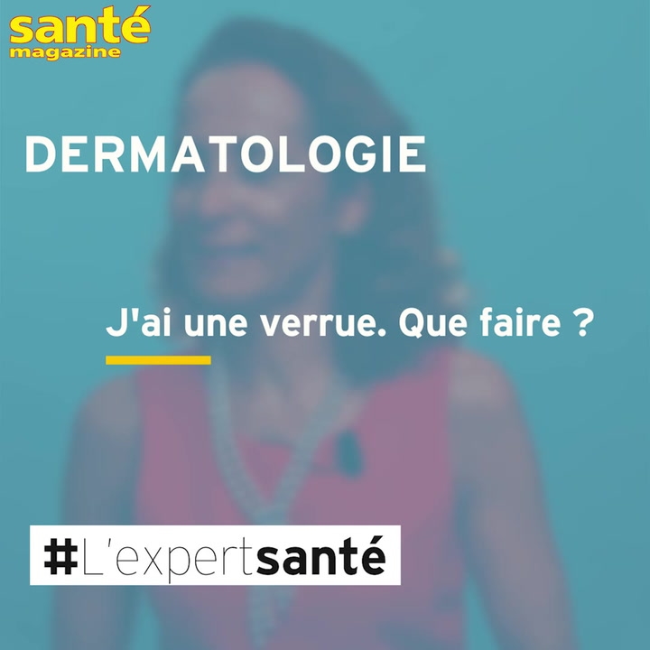 Comment Reagir A L Apparition D Une Verrue Reponse Video Sante Magazine