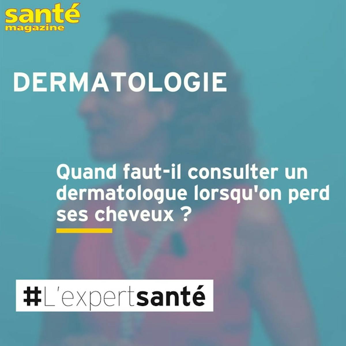 Chute de cheveux : quand consulter un dermato ? Réponse vidéo | Santé ...